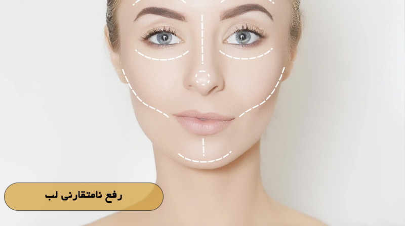رفع نامتقارنی لب