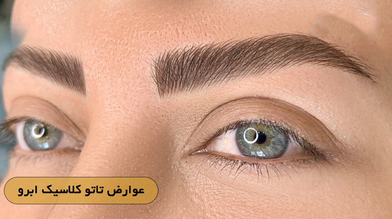عوارض تاتو کلاسیک ابرو 