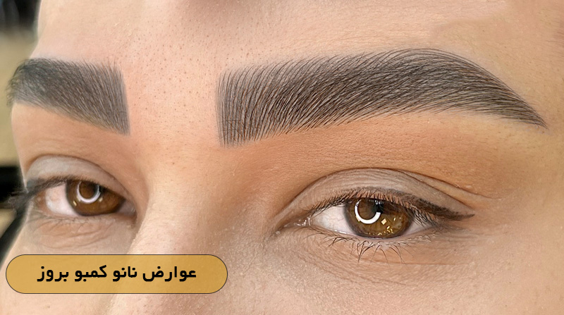 عوارض نانو کمبو بروز