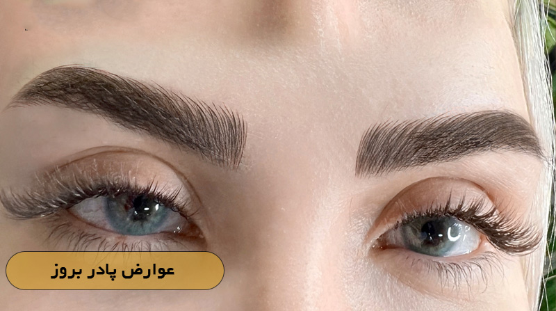  عوارض پادر بروز