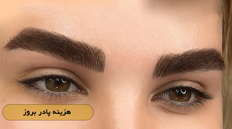  هزینه پادر بروز