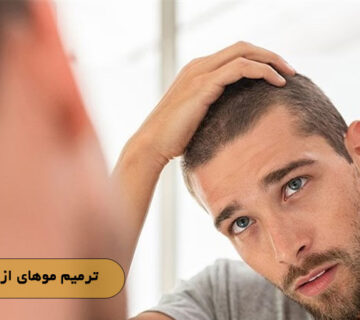 ترمیم موهای از دست رفته