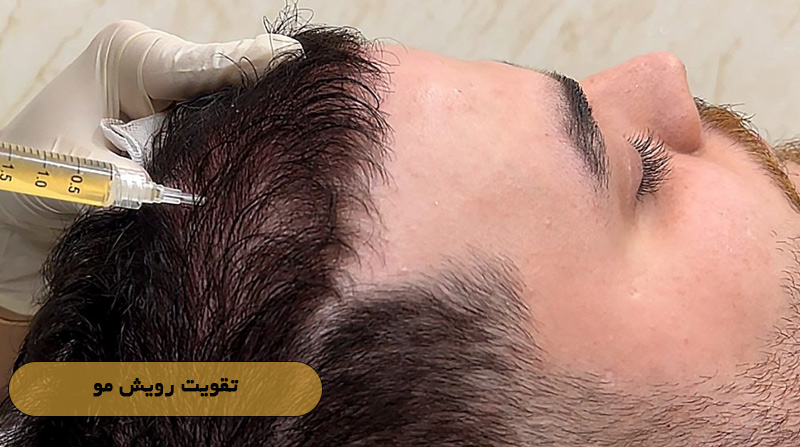 تقویت رویش مو