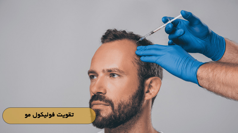 تقویت فولیکول مو