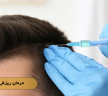 درمان ریزش مو ارثی