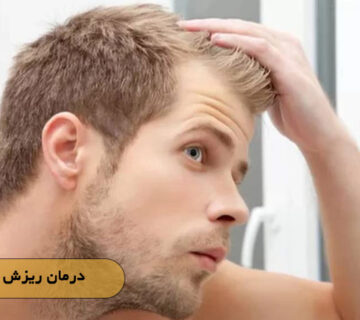 درمان ریزش مو مردان