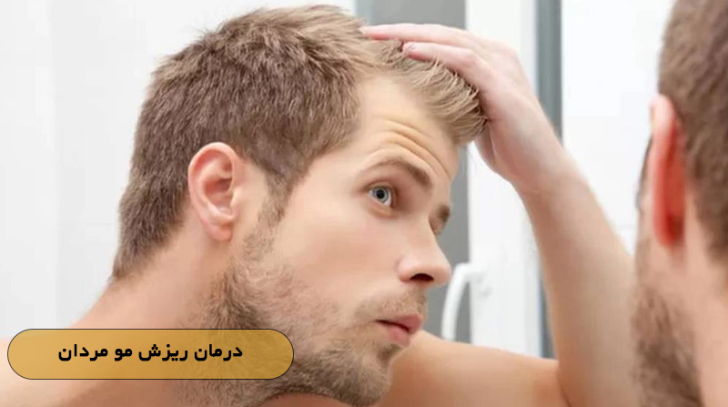 درمان ریزش مو مردان