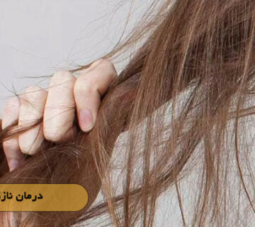 درمان نازکی مو