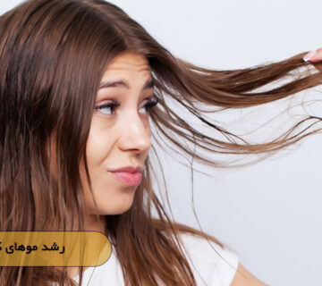 رشد موهای کم پشت