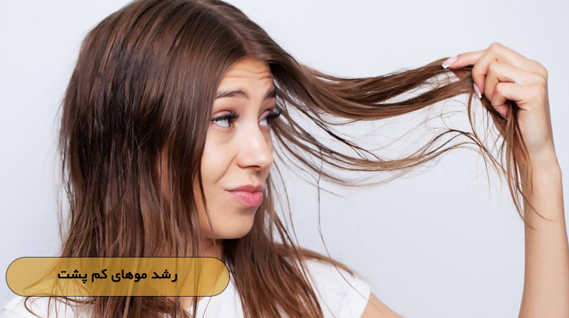 رشد موهای کم پشت