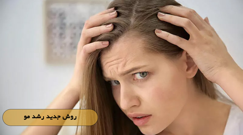 روش جدید رشد مو