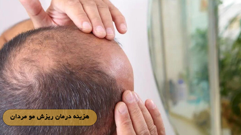 هزینه درمان ریزش مو مردان
