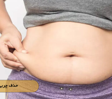 حذف چربی پهلو