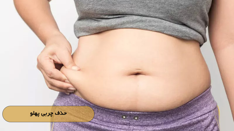 حذف چربی پهلو
