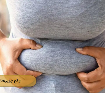 رفع چربی‌های مقاوم