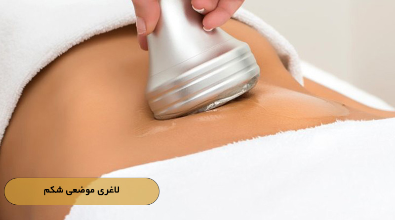 لاغری موضعی شکم