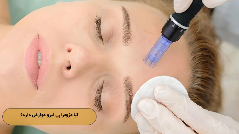 آیا مزوتراپی ابرو عوارض دارد؟