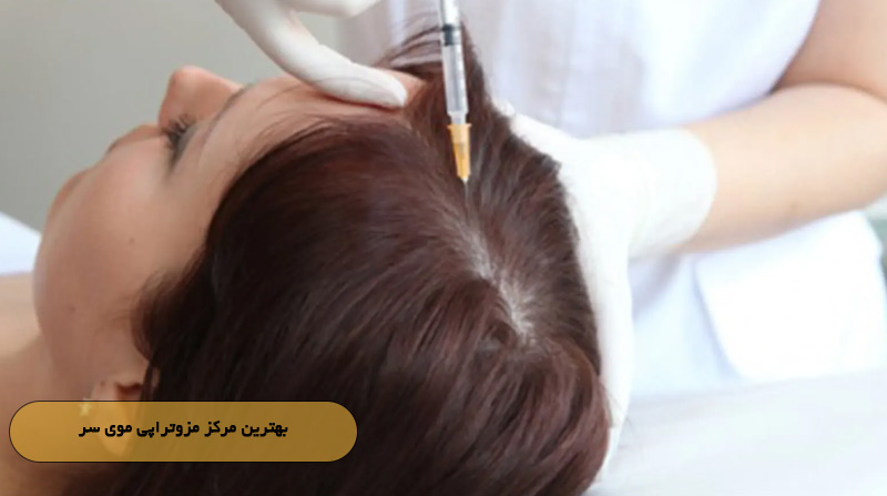 بهترین مرکز مزوتراپی موی سر