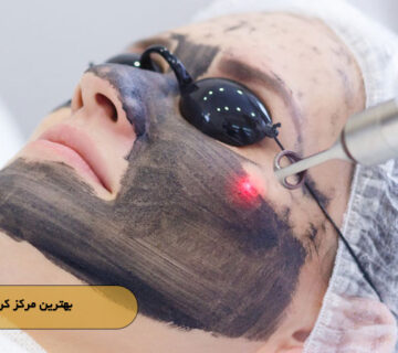 بهترین مرکز کربن‌ تراپی