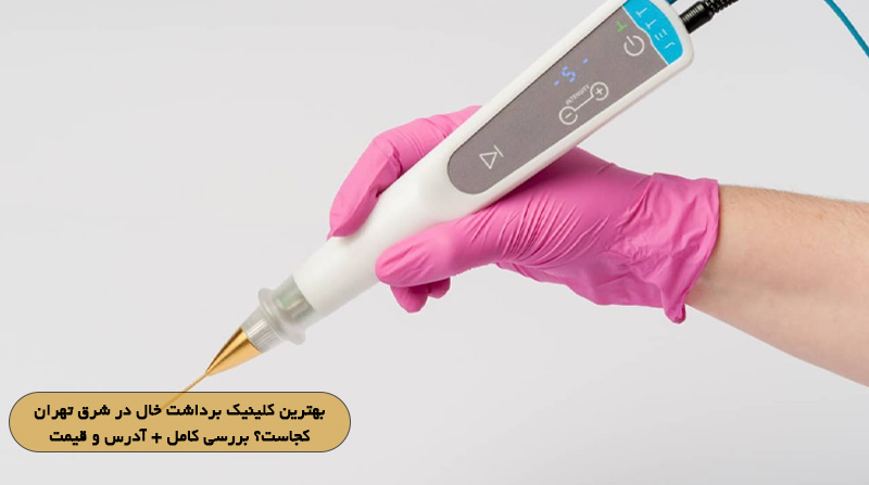 بهترین کلینیک برداشت خال در شرق تهران کجاست؟ بررسی کامل + آدرس و قیمت