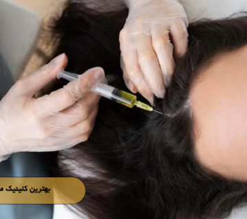 بهترین کلینیک مزوتراپی مو
