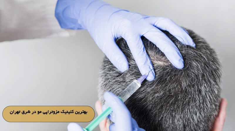 بهترین کلینیک مزوتراپی مو در شرق تهران