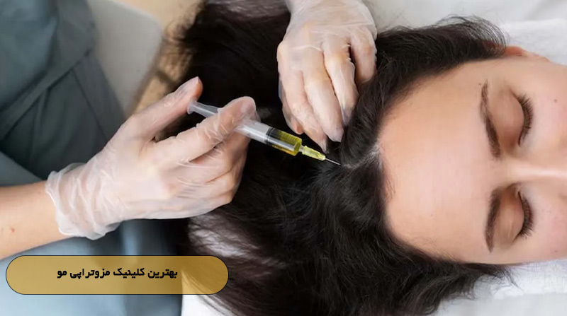 بهترین کلینیک مزوتراپی مو
