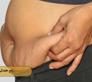رفع افتادگی شکم