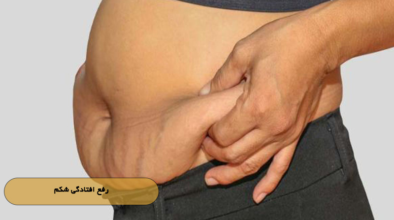 رفع افتادگی شکم