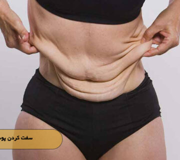 سفت کردن پوست شکم