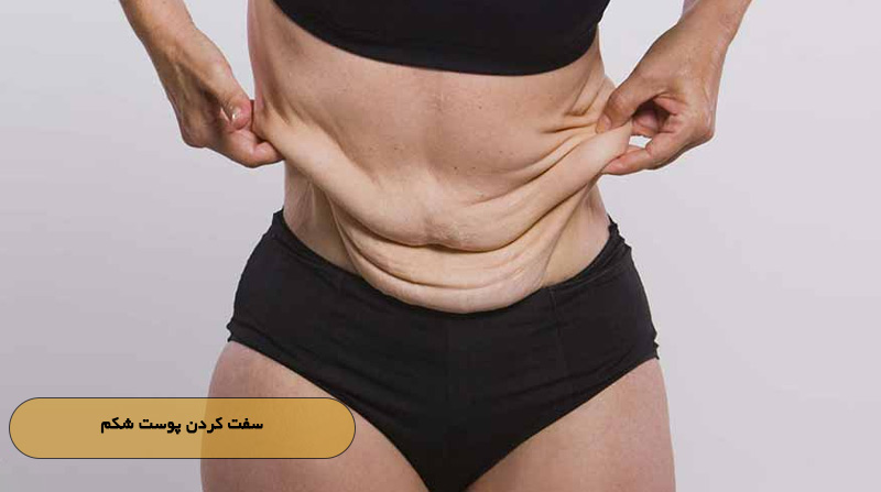 سفت کردن پوست شکم