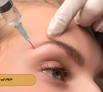 مزوتراپی ابرو