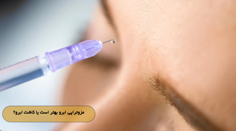 مزوتراپی ابرو بهتر است یا کاشت ابرو؟