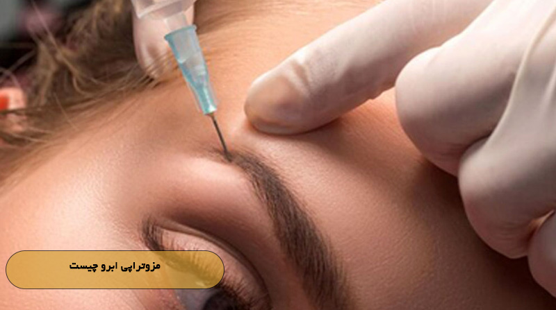 مزوتراپی ابرو چیست