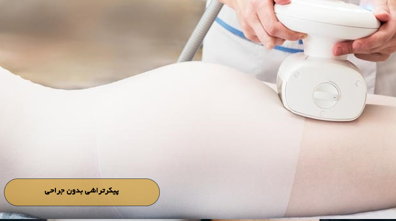 پیکرتراشی بدون جراحی