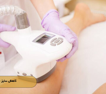 کاهش سایز موضعی