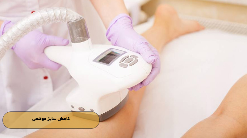 کاهش سایز موضعی