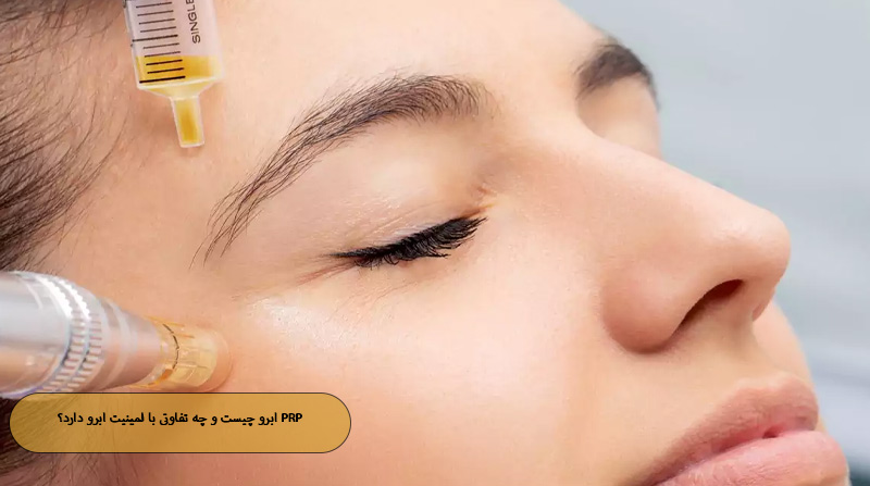 PRP ابرو چیست و چه تفاوتی با لمینیت ابرو دارد؟