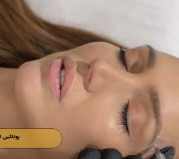 بوتاکس ابرو