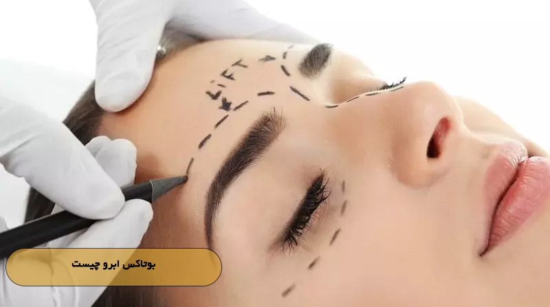 بوتاکس ابرو چیست