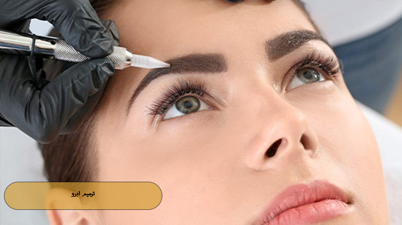 ترمیم ابرو