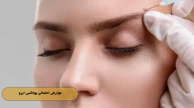 عوارض احتمالی بوتاکس ابرو