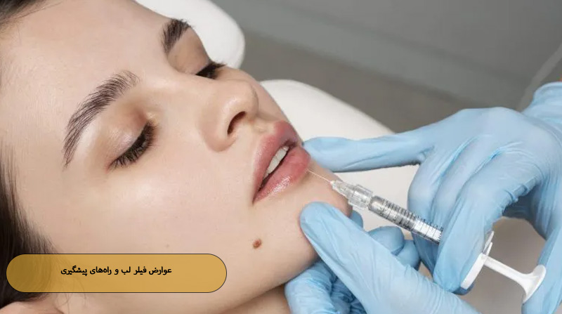 عوارض فیلر لب و راه‌های پیشگیری