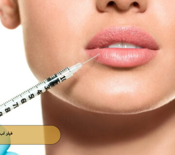 فیلر لب