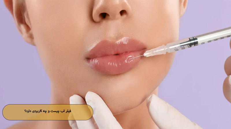 فیلر لب چیست و چه کاربردی دارد؟
