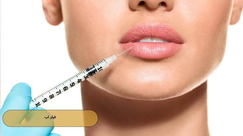 فیلر لب
