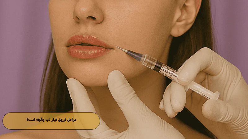مراحل تزریق فیلر لب چگونه است؟