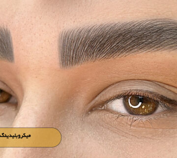 میکروبلیدینگ کلاسیک