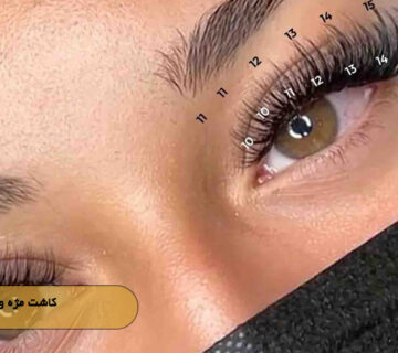 کاشت مژه ویسپی