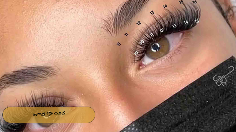 کاشت مژه ویسپی